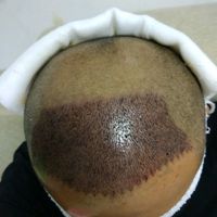 發(fā)際線用戶圖片