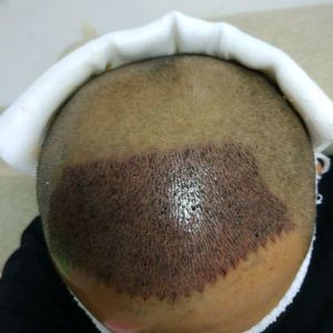 发际线分享社区