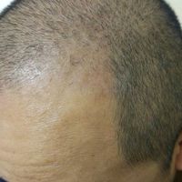 發(fā)際線用戶圖片