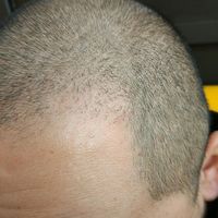 發(fā)際線用戶圖片
