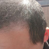 發(fā)際線用戶圖片