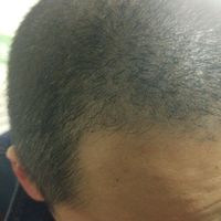 發(fā)際線用戶圖片