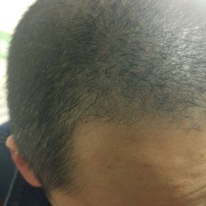 发际线分享社区