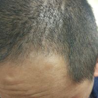 發(fā)際線用戶圖片