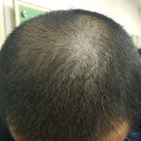 發(fā)際線用戶圖片