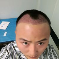 發(fā)際線用戶圖片