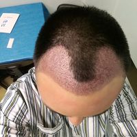 發(fā)際線用戶圖片