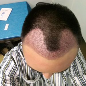 发际线分享社区