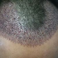 發(fā)際線用戶圖片