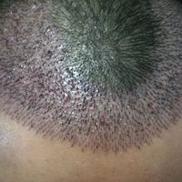 發(fā)際線用戶圖片