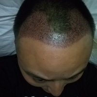 發(fā)際線用戶圖片