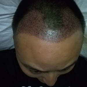 发际线分享社区