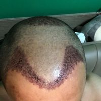 發(fā)際線用戶圖片