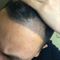 發(fā)際線用戶圖片