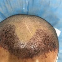 發(fā)際線用戶圖片
