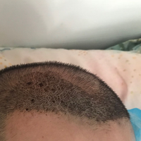 發(fā)際線用戶圖片