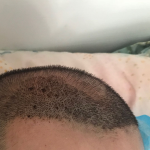 发际线分享社区