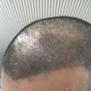 发际线分享社区