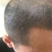 發(fā)際線用戶圖片