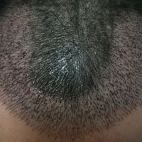 發(fā)際線用戶圖片