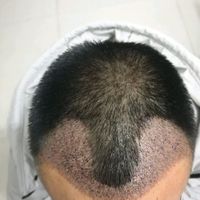 發(fā)際線(xiàn)用戶(hù)圖片