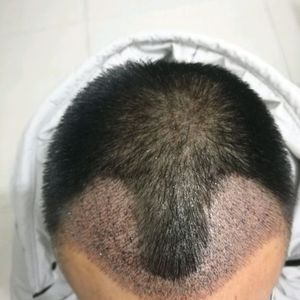 发际线分享社区
