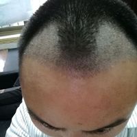 發(fā)際線(xiàn)用戶(hù)圖片