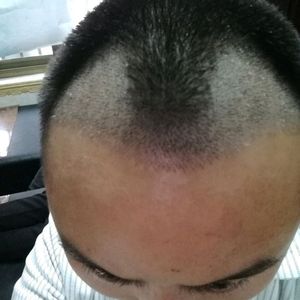 发际线分享社区