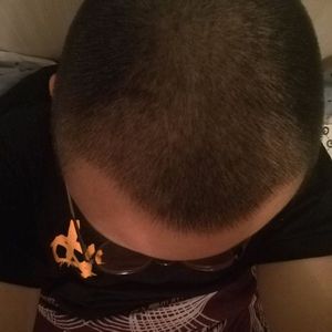 发际线分享社区