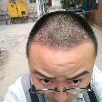 發(fā)際線(xiàn)用戶(hù)圖片