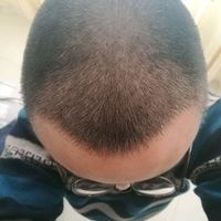 發(fā)際線(xiàn)用戶(hù)圖片