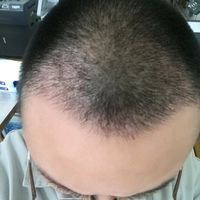 發(fā)際線(xiàn)用戶(hù)圖片