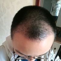 發(fā)際線(xiàn)用戶(hù)圖片