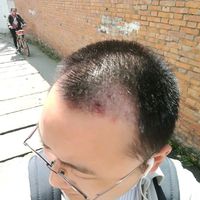發(fā)際線(xiàn)用戶(hù)圖片