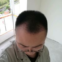 發(fā)際線(xiàn)用戶(hù)圖片