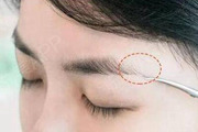 植眉毛要多少钱?植眉前后注意事项有哪些?