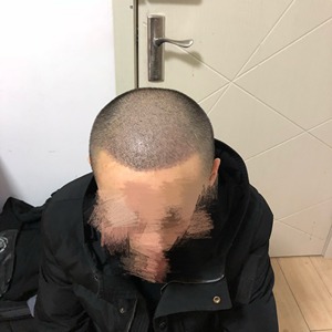 发际线分享社区
