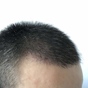 发际线分享社区