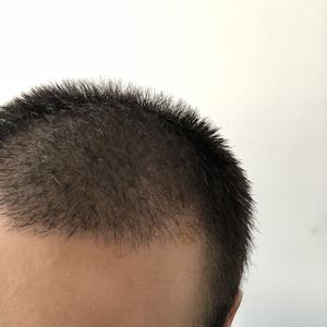 发际线分享社区