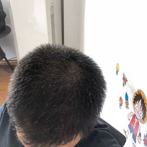 发际线分享社区