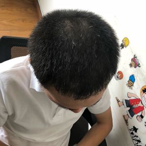 发际线分享社区