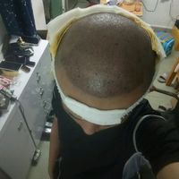 發(fā)際線用戶圖片