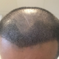 發(fā)際線用戶圖片