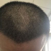 發(fā)際線用戶圖片