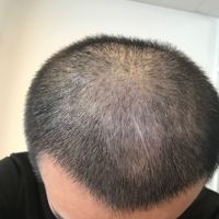 發(fā)際線用戶圖片