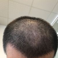 發(fā)際線用戶圖片