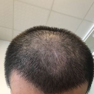 发际线分享社区