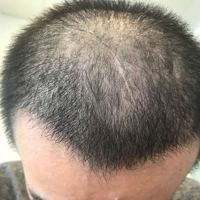 發(fā)際線用戶圖片