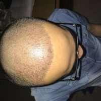 發(fā)際線用戶圖片