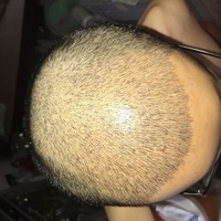 發(fā)際線用戶圖片